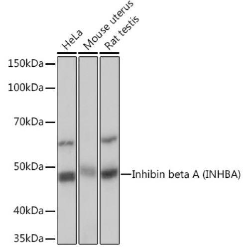 Inhibin beta A (INHBA) Rabbit mAb