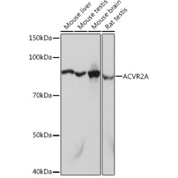 [KO Validated] ACVR2A Rabbit mAb