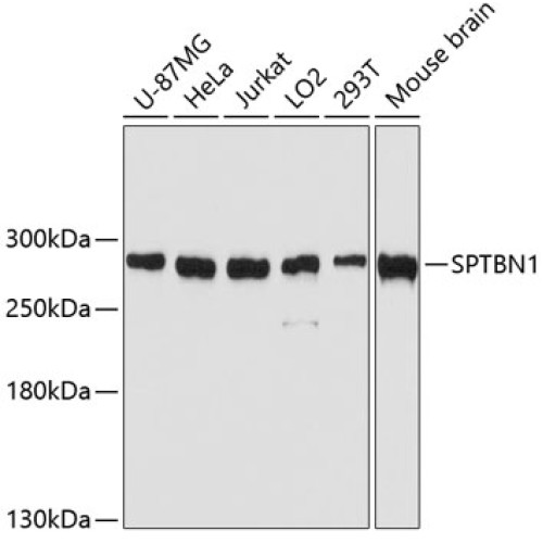 SPTBN1 Rabbit pAb