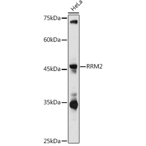 RRM2 Rabbit pAb