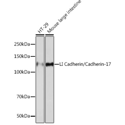LI Cadherin/Cadherin-17 Rabbit mAb