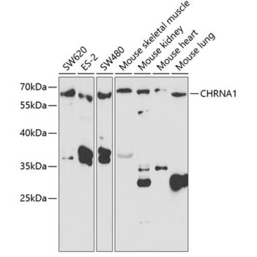 CHRNA1 Rabbit pAb