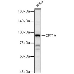 CPT1A Rabbit pAb
