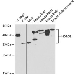 NDRG2 Rabbit pAb