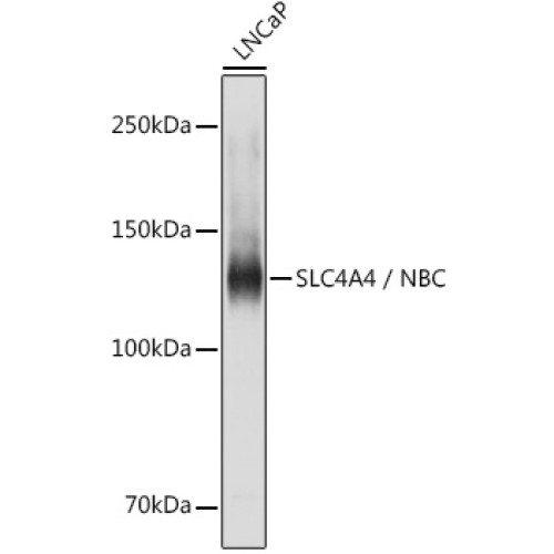 SLC4A4 / NBC Rabbit pAb
