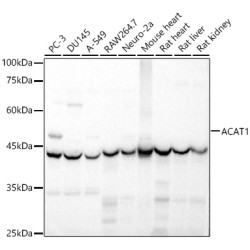 ACAT1 Rabbit pAb