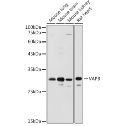 VAPB Rabbit pAb