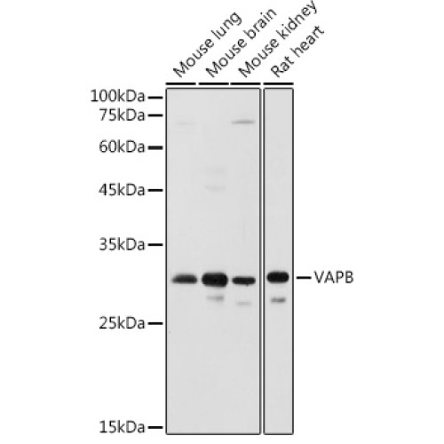 VAPB Rabbit pAb