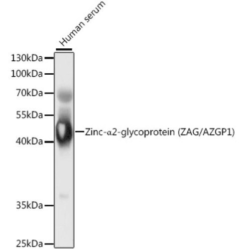 Zinc-α2-glycoprotein (ZAG/AZGP1) Rabbit pAb