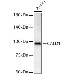 CALD1 Rabbit pAb