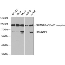 RanGAP1 Rabbit pAb