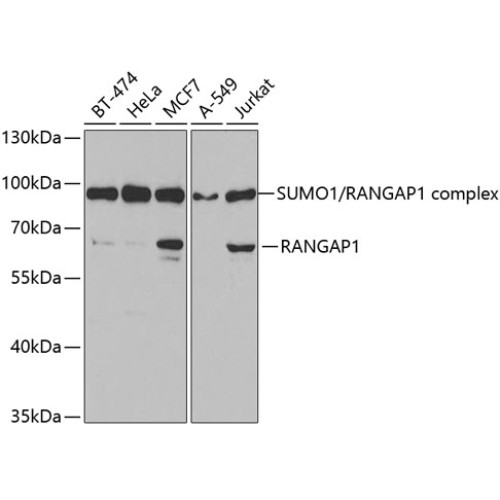 RanGAP1 Rabbit pAb
