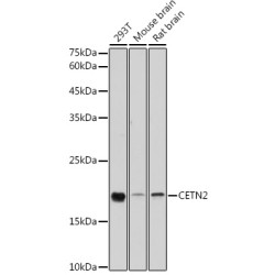 [KO Validated] CETN2 Rabbit pAb