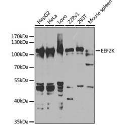 [KO Validated] EEF2K Rabbit pAb