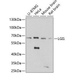 LGI1 Rabbit pAb