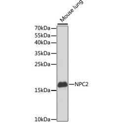 NPC2 Rabbit pAb