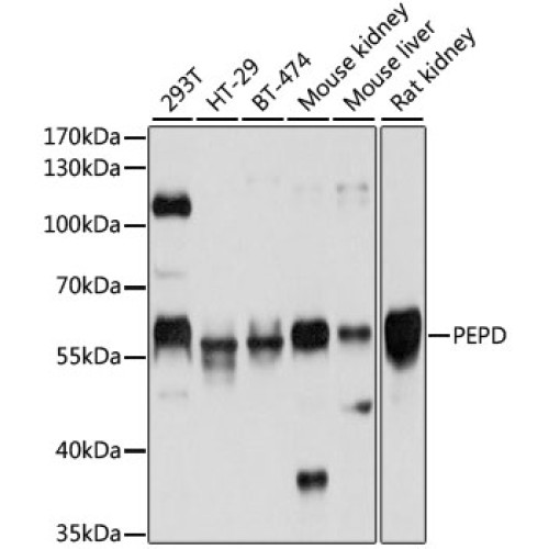 PEPD Rabbit pAb