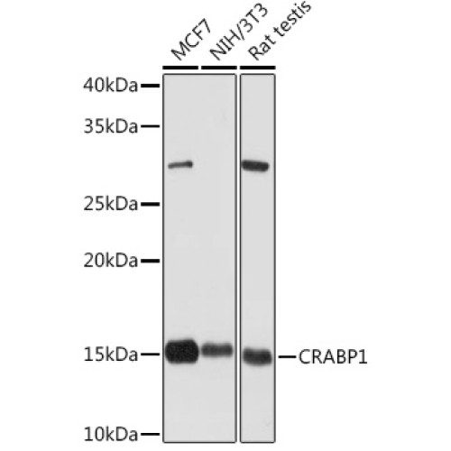 CRABP1 Rabbit mAb