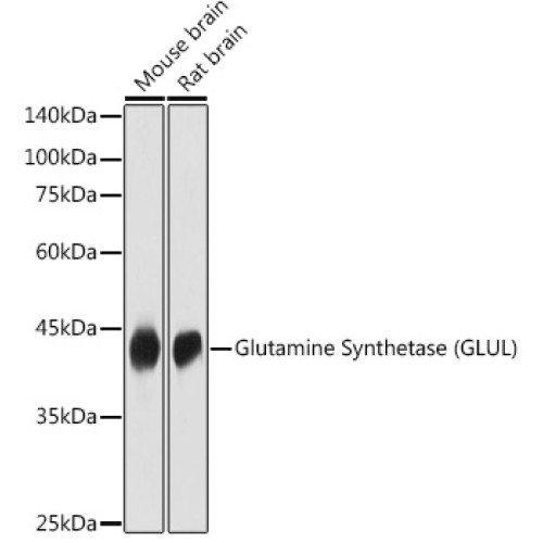 Glutamine Synthetase (GLUL) Rabbit pAb