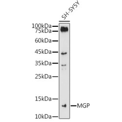 MGP Rabbit pAb