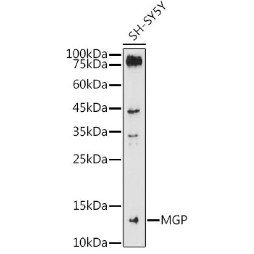 MGP Rabbit pAb