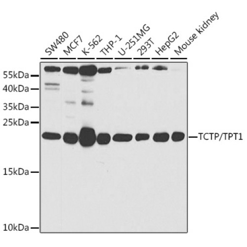 TCTP/TPT1 Rabbit pAb