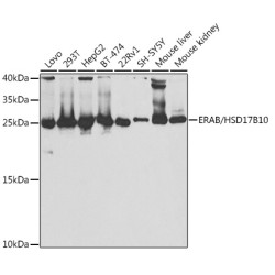 ERAB/HSD17B10 Rabbit pAb