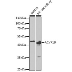 ACVR1B Rabbit pAb
