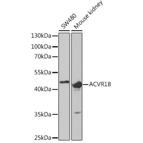 ACVR1B Rabbit pAb