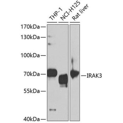 IRAK3 Rabbit pAb