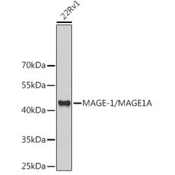 MAGE-1/MAGE1A Rabbit pAb