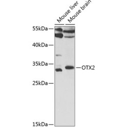 OTX2 Rabbit pAb