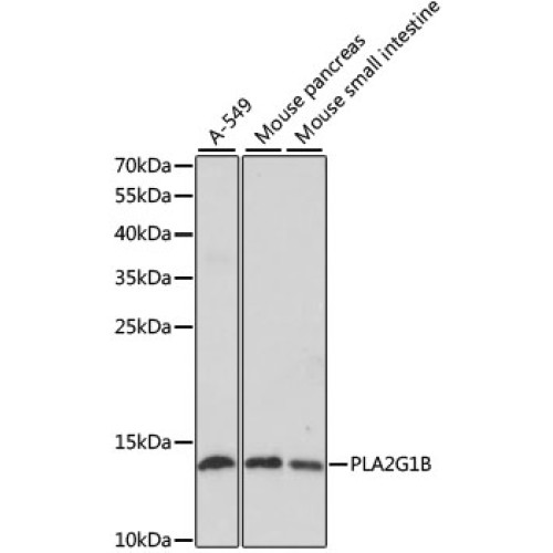 PLA2G1B Rabbit pAb