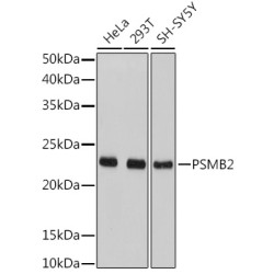 PSMB2 Rabbit pAb