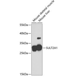 SULT2A1 Rabbit pAb