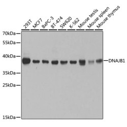 [KO Validated] DNAJB1 Rabbit pAb