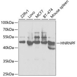 [KO Validated] HNRNPF Rabbit pAb