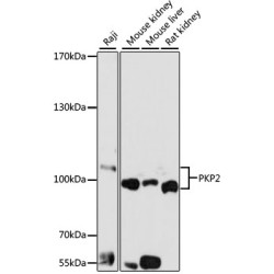 PKP2 Rabbit pAb