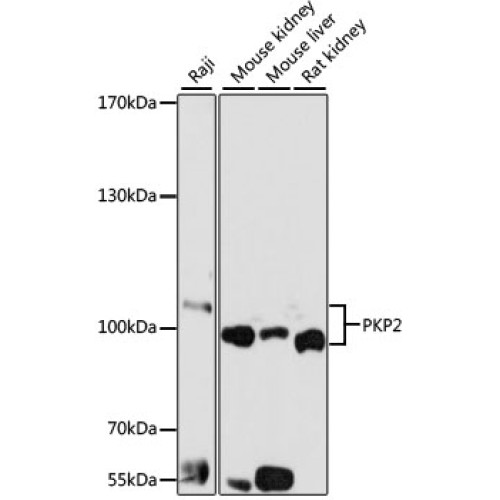 PKP2 Rabbit pAb