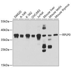 RPLP0 Rabbit pAb