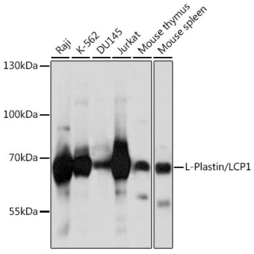 L-Plastin/LCP1 Rabbit pAb