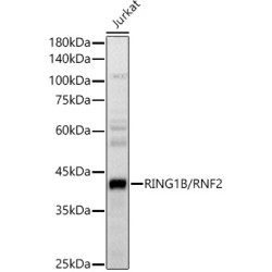 RING1B/RNF2 Rabbit pAb