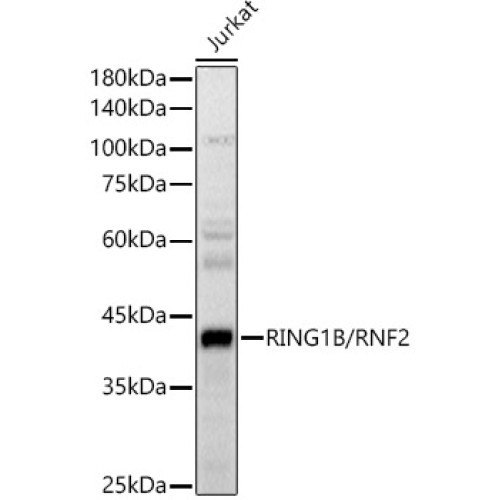 RING1B/RNF2 Rabbit pAb