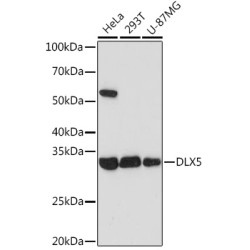 DLX5 Rabbit mAb