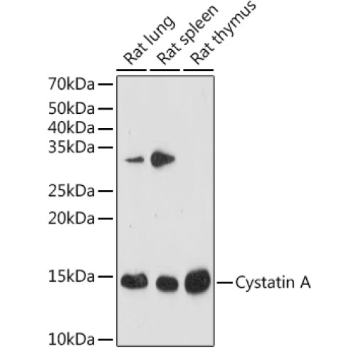 Cystatin A Rabbit mAb