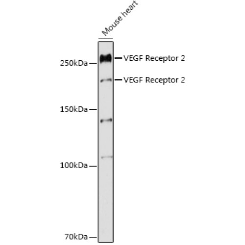 VEGF Receptor 2 Rabbit pAb