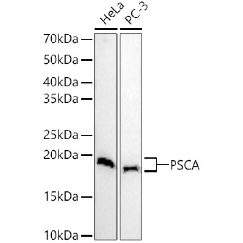 PSCA Rabbit pAb