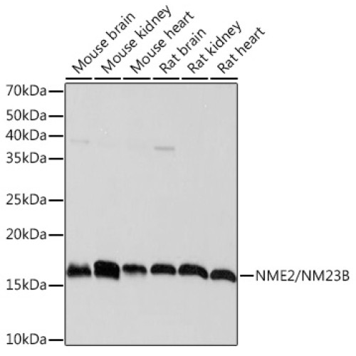 NME2/NM23B Rabbit mAb