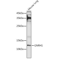 GNRH1 Rabbit pAb