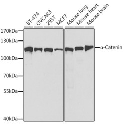 [KO Validated] α-Catenin Rabbit pAb
